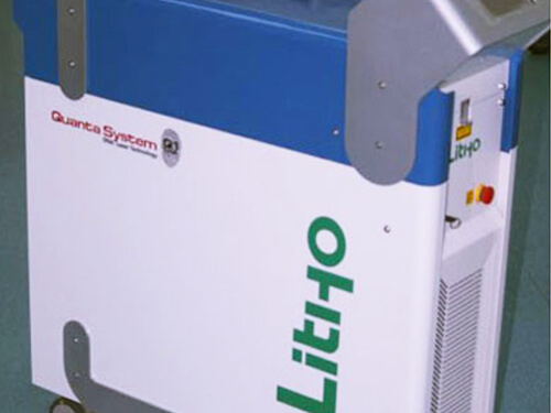 Holmium Laser for Urinary Stones